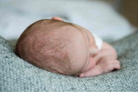 Die Entwicklung der Kopfform deines Babys - und wie lang du sie beobachten solltest!