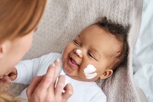 Milchschorf bei Babys - was kannst du dagegen tun?
